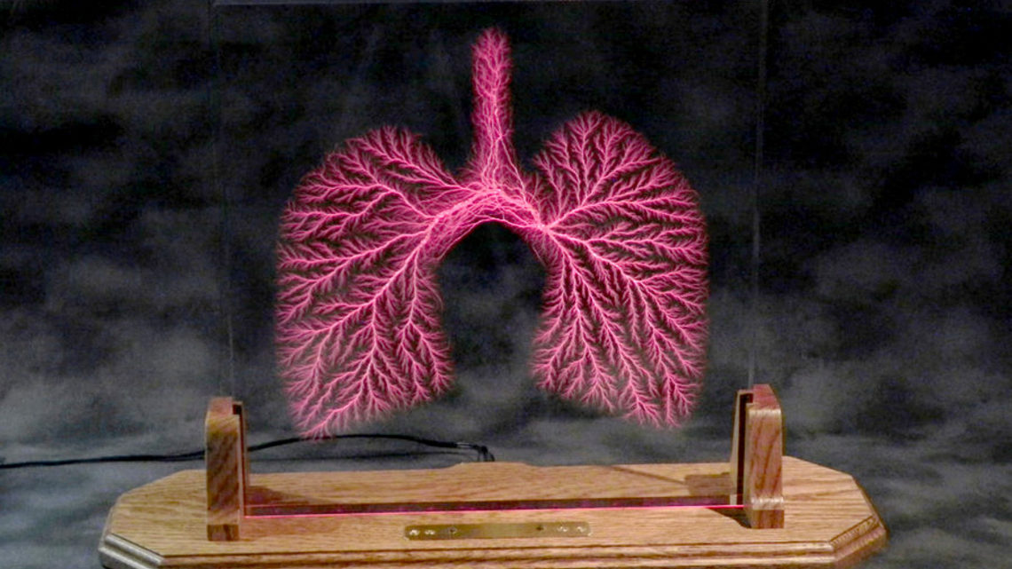 Image of The electron paths mimic the capillaries in a pair of lungs in artwork commissioned for a physician