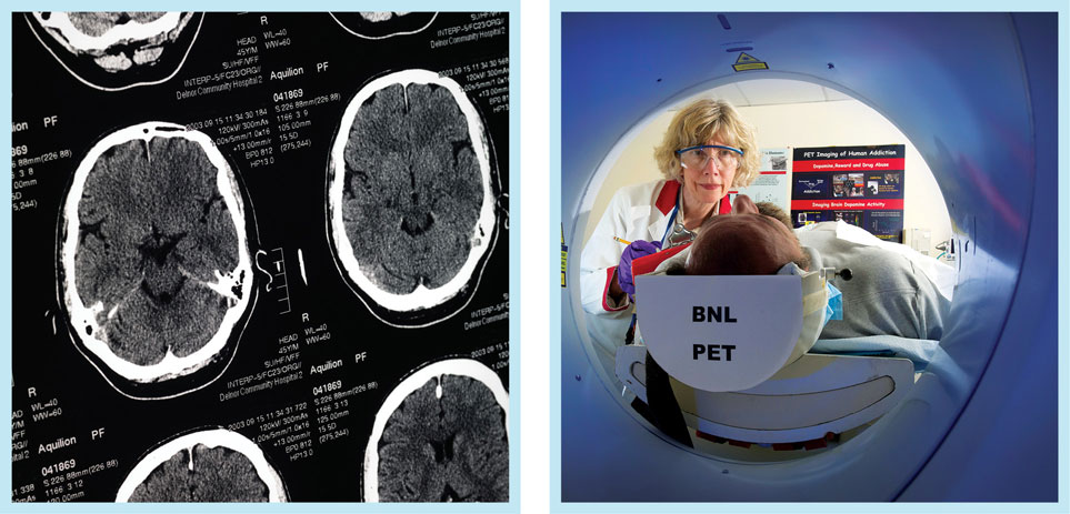 Photo of Tracking technology developed for particle physics made MRI (left) and PET (right) scans possible
