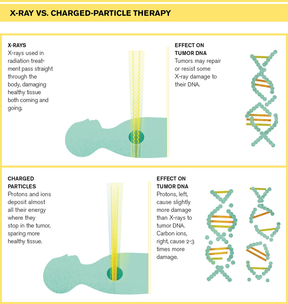 Illustration of Xray Charged Particles Therapy Chart