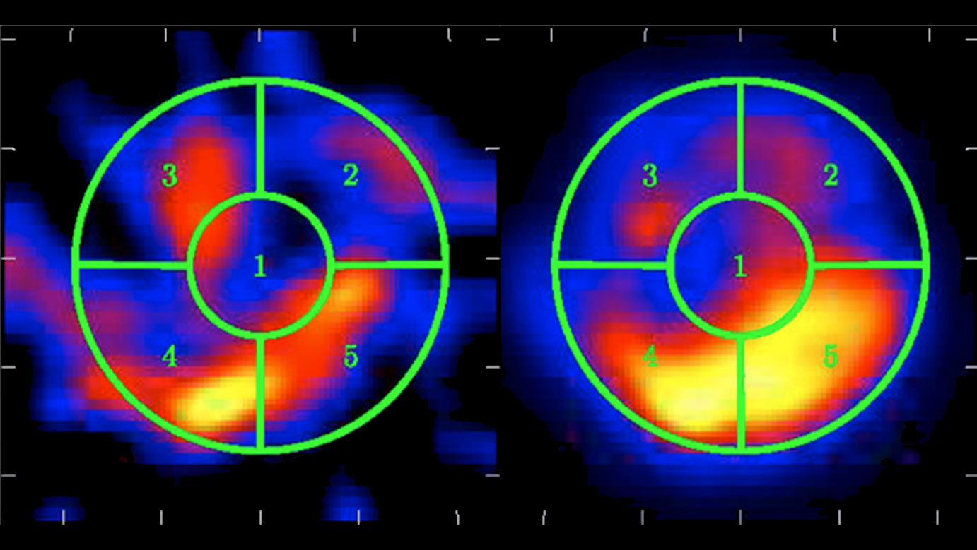 Image of Supernova S147