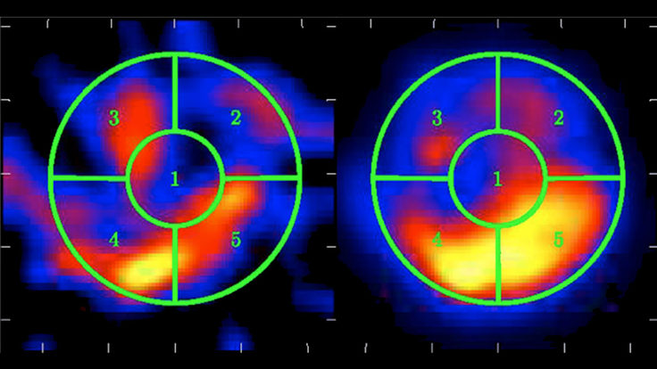 Image of Supernova S147
